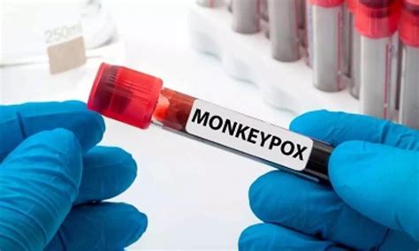 Mpox get tested th.jpeg